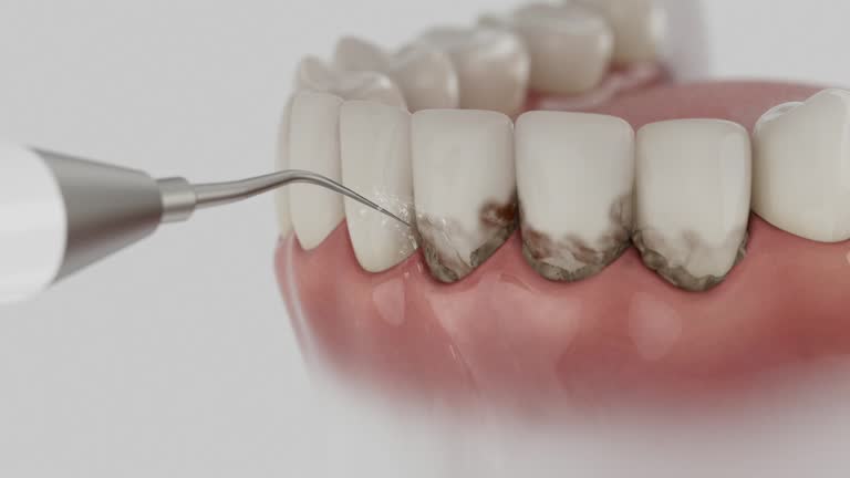 Reliable Teeth Cleaning And Checkup contractor in Johnson County County, GA by Dentist Open Now